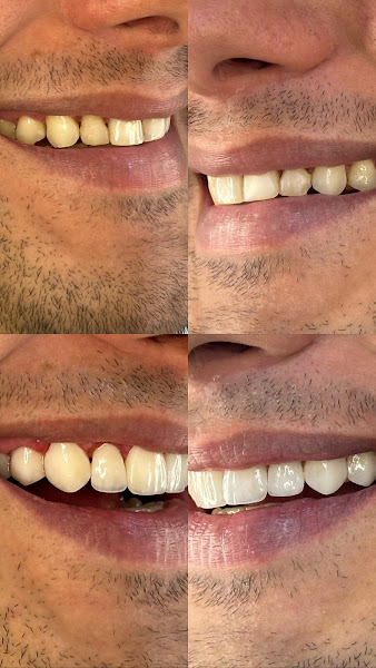 Foto 2 de Dentix Odontologia Centro | Dentista em Petrolina