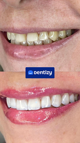 Foto 3 de Dentizy