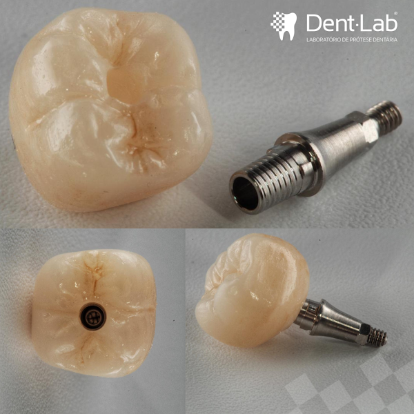 Foto 2 de DentLab - Laboratório de Prótese Dentária Digital