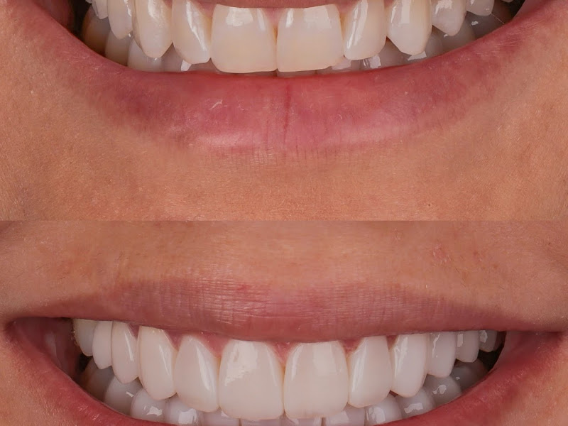 Foto 7 de DentPrime