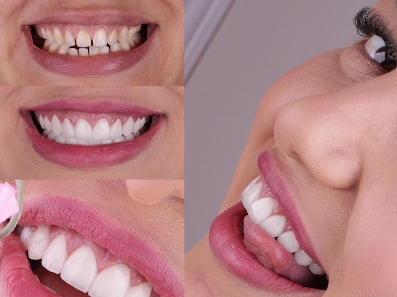 Foto 9 de DentSolution