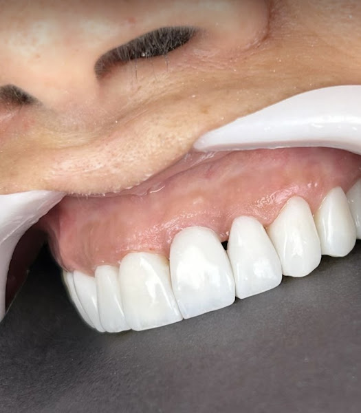 Foto 2 de Dentunes Odontologia