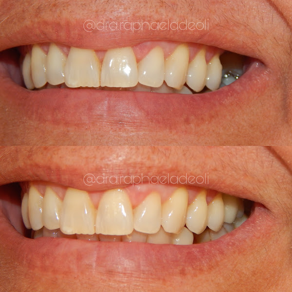 Foto 2 de Deoli Odontologia - ortodontia, estética e reabilitação dental