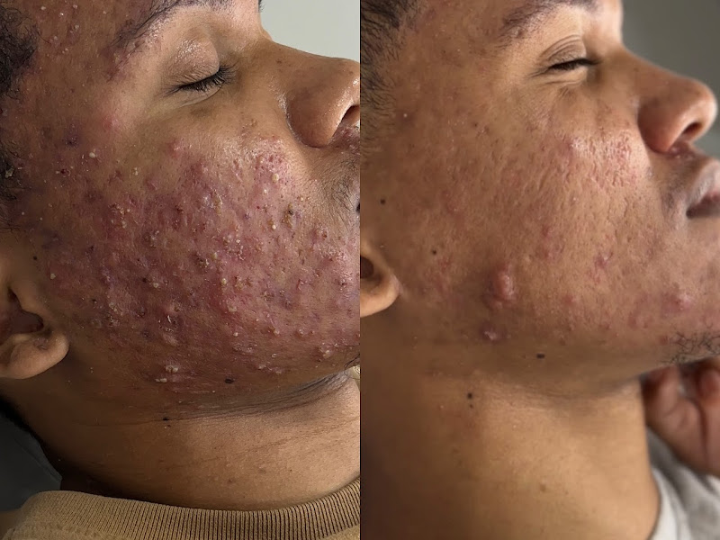 Foto 3 de Dermaclin Saúde e Bem-Estar