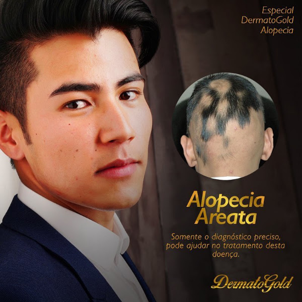 Foto 3 de DermatoGold - Estética e Dermatologia - Santa Rita, Macapá