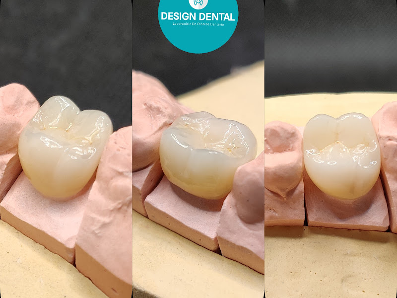 Foto 2 de Design Dental - Laboratório de Prótese Dentária