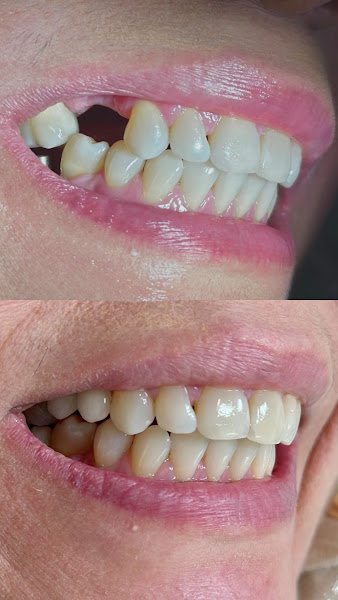 Foto 3 de Design do Sorriso | Implantes em Manaus