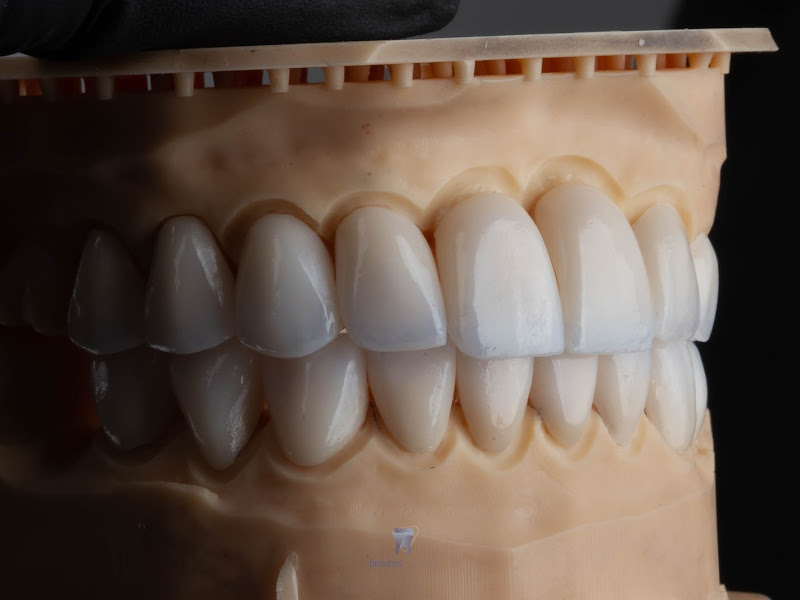 Foto de Detalhes Próteses