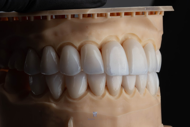 Foto 2 de Detalhes Próteses