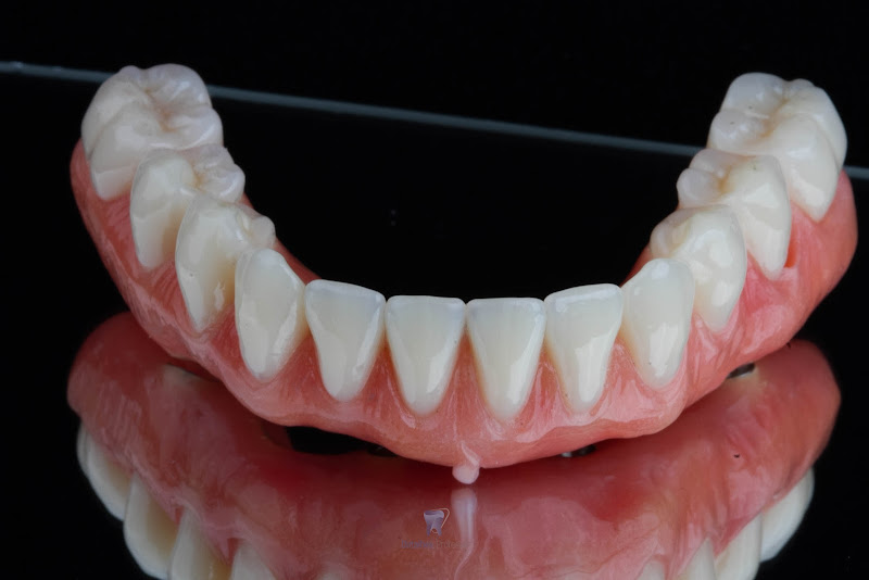 Foto 3 de Detalhes Próteses