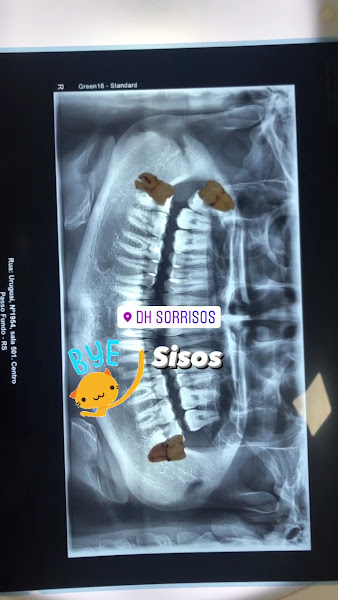Foto 2 de DH Sorrisos