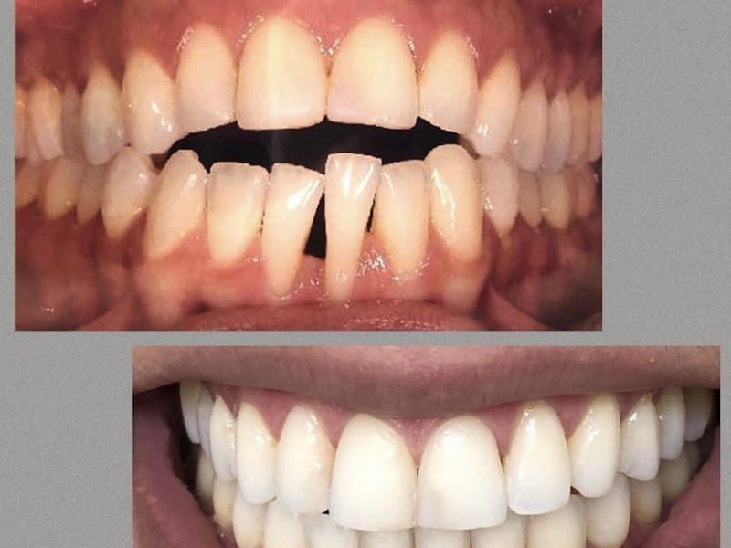 Foto 8 de Diadents |Lentes de Porcelana |Odontologia Clínica e Harmonização Facial em Diadema