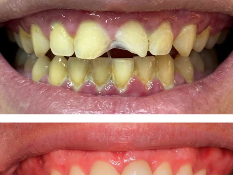 Foto 11 de Diamond Clinic Centro: Clínica Odontológica, Estética Facial em Niterói RJ