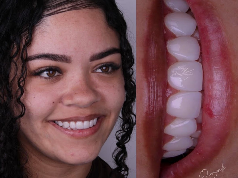 Foto 7 de Diamond Odontologia e Estética Facial