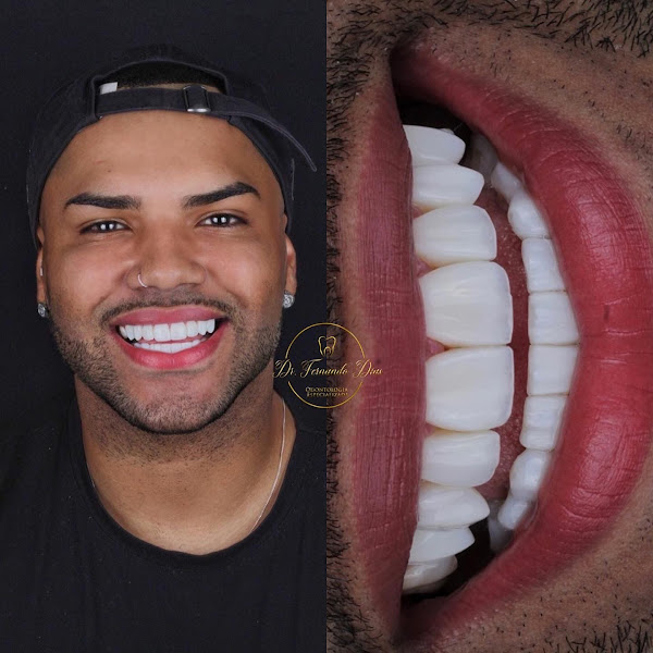 Foto 3 de DIAS ODONTOLOGIA ESPECIALIZADA - Dentista Embu das Artes