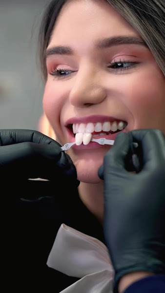 Foto 3 de Diego Gonçalves e Gabriela Vasconcelos - Implante Dentário João Pessoa | Lente de Contato Dental | Facetas de Porcelana