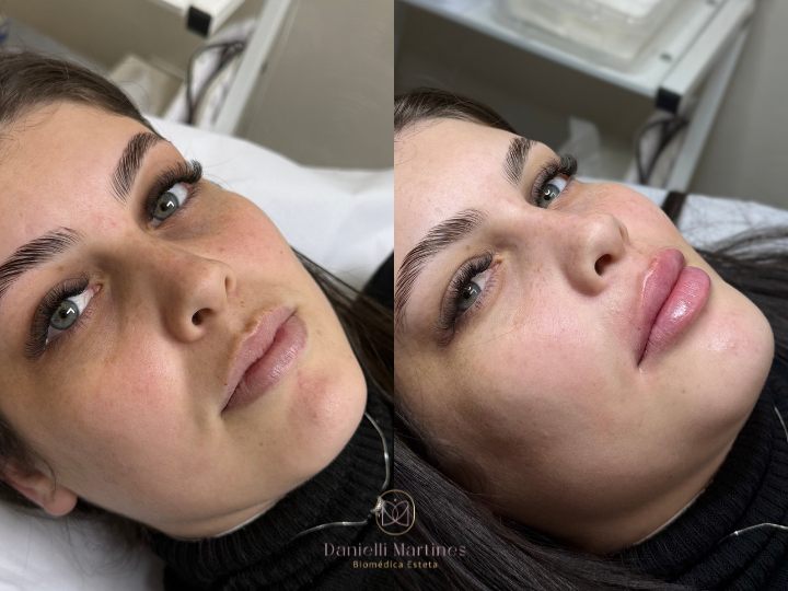 Foto 2 de DM Clínica de Estética | Harmonização Facial | Limpeza de Pele | Depilação a Laser | São Bernardo do Campo-SP