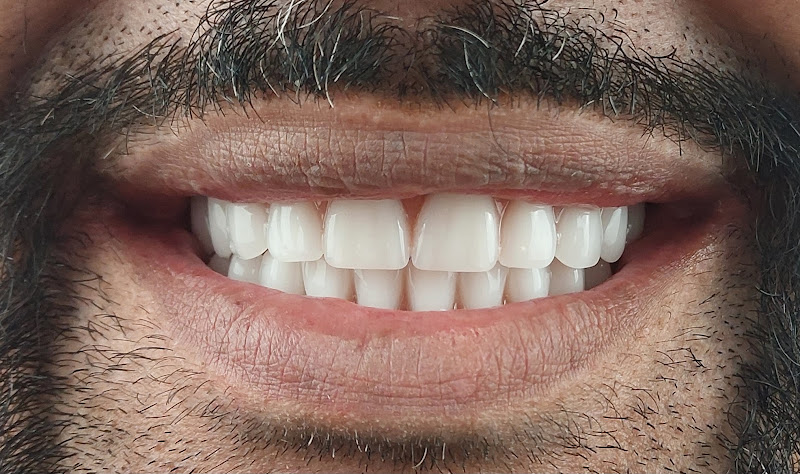 Foto 3 de Dm Implantes | Clínica Odontológica