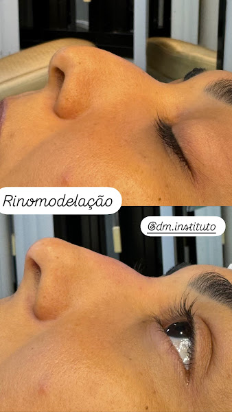 Foto 3 de DM Instituto harmonização Facial e Corporal