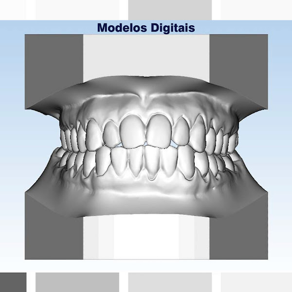 Foto 3 de Doc Ideal XG Radiologia e Documentação Odontológica