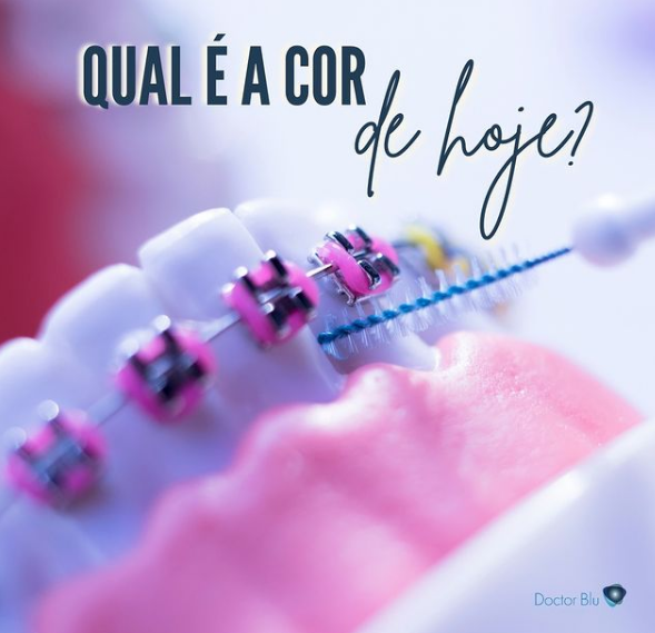 Foto 3 de Doctor Blu Odontologia - Zico