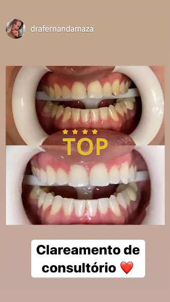 Foto 5 de Doctor D Clínica Odontológica | Porto Canoa ES