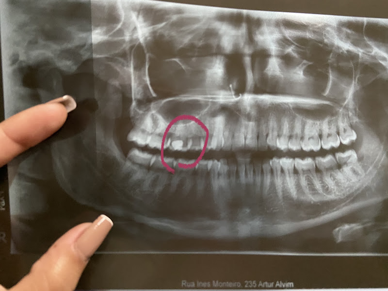 Foto 2 de Dodoclin Dentista