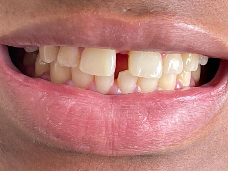 Foto 9 de Dolci Braghini - Clinica Odontológica / Dentista no Menino Deus