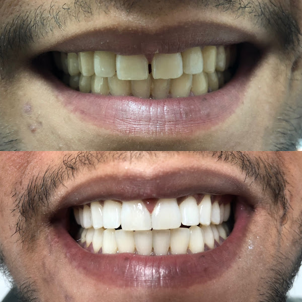 Foto 2 de Dórea Odontologia - Implantes, Próteses, Aparelhos e Clareamento