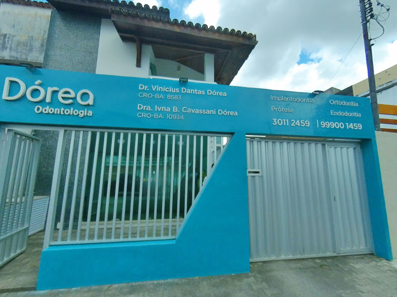 Foto 3 de Dórea Odontologia - Implantes, Próteses, Aparelhos e Clareamento