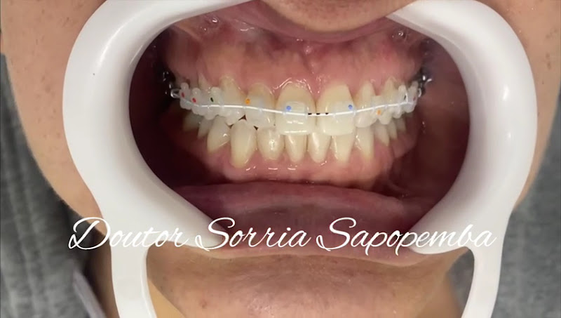 Foto 3 de Doutor Sorria Mais