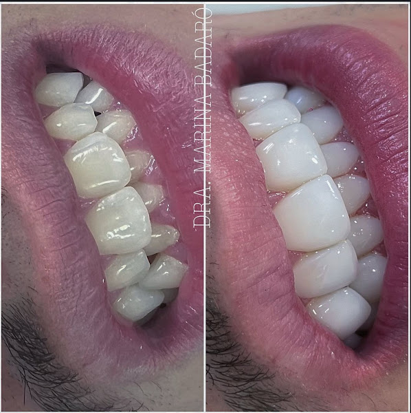 Foto 3 de Doutora Marina Badaró Odontologia e Estética - Dentista - Especialista em Harmonização Orofacial e Implante