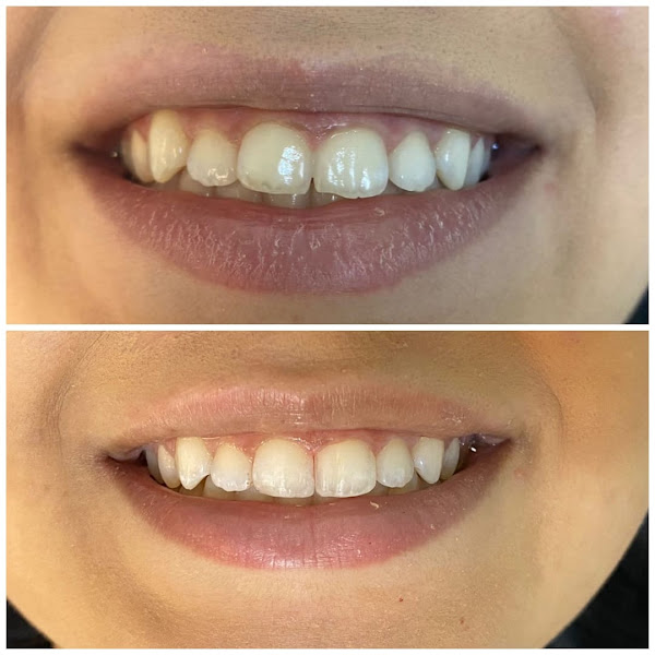 Foto 3 de Dr.a Laís Clarindo - Consultório Odontológico