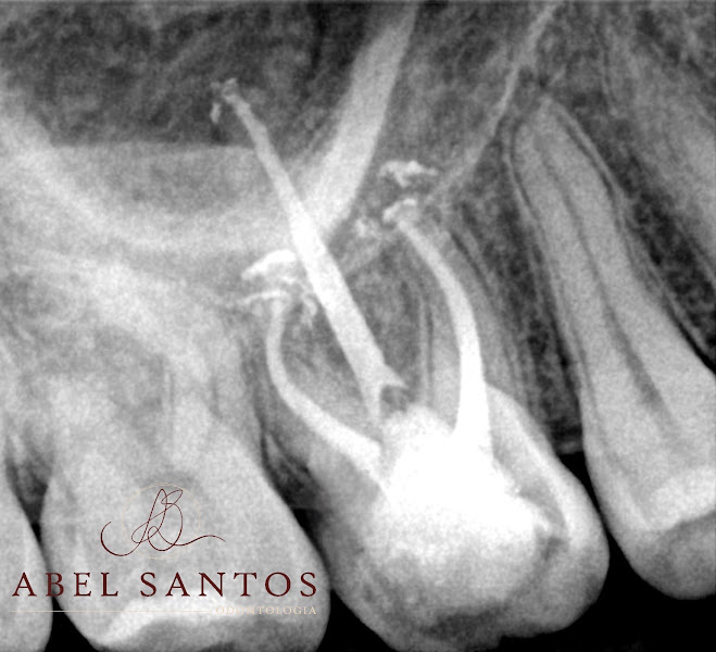 Foto 3 de Dr Abel Santos - Endodontista