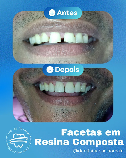 Foto 3 de Dr. Absalão Maia - Consultório Odontológico