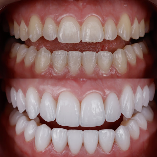 Foto 3 de Dr. Adriano Rafael Odontologia Estética Avançada