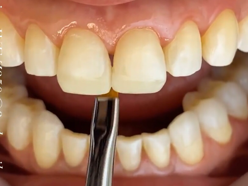 Foto 3 de Dr.Adriel Cavalcante Dentista - Manaus