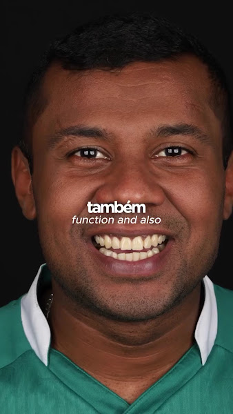 Foto 3 de Dr Ady Reis | Ponce Odontologia - Lentes de contato dental | Implantes dentários