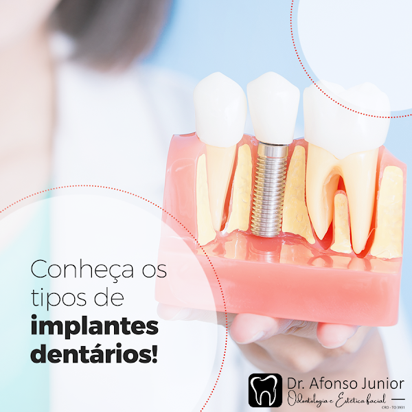 Foto 3 de Dr Afonso Junior