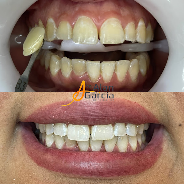 Foto 2 de Dr. Alan Garcia | Dentista