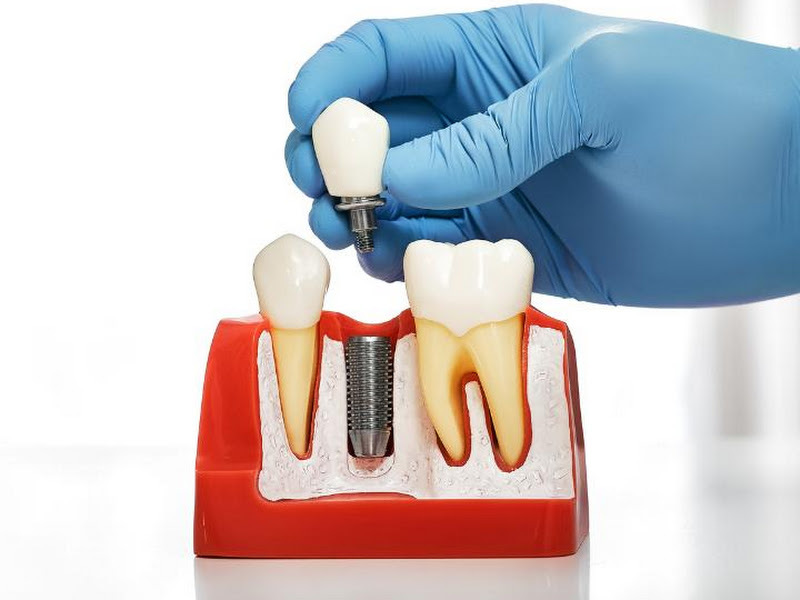 Foto 2 de Dr. Alberto Couto, Dentista