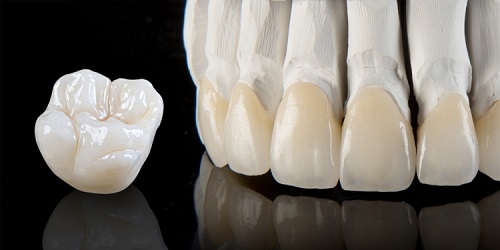 Foto 2 de Dr Aldo Malatesta Jr Cirurgião Dentista/ Clinico Geral/Prótese