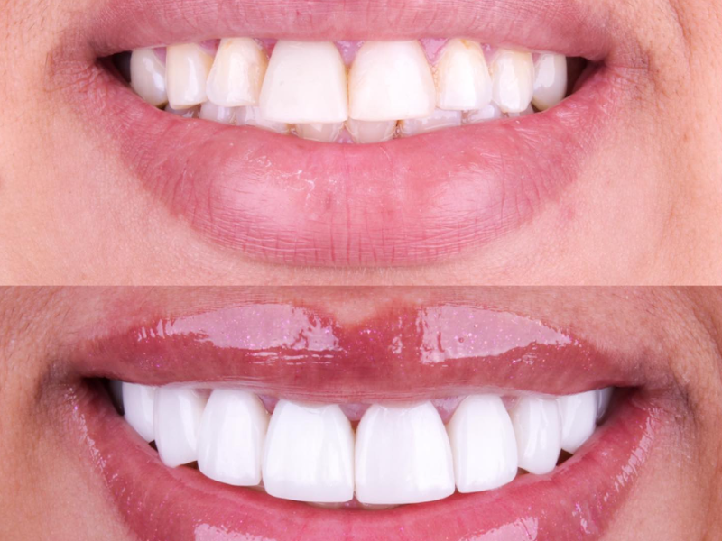 Foto 4 de Dr Alessandro Marcos Delfini ( Delfini Odontologia )