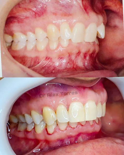 Foto 2 de Dr. Alex Torres - ImplanteJá
