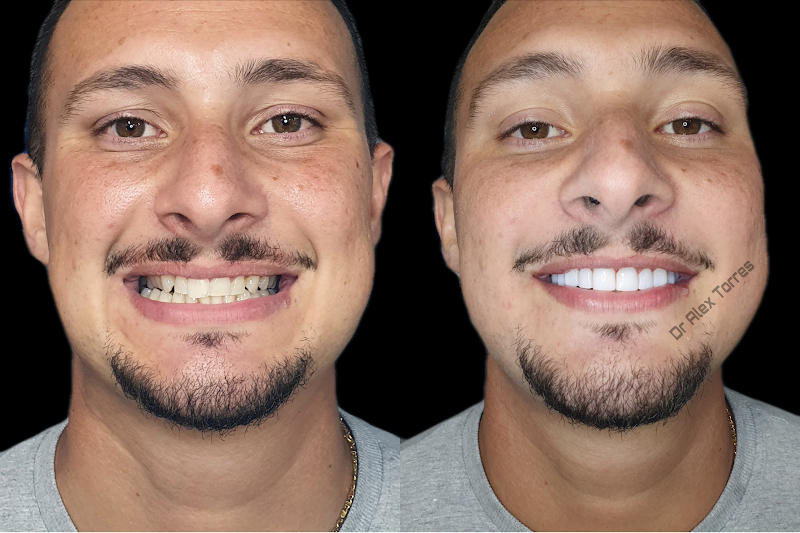 Foto 3 de Dr. Alex Torres - ImplanteJá