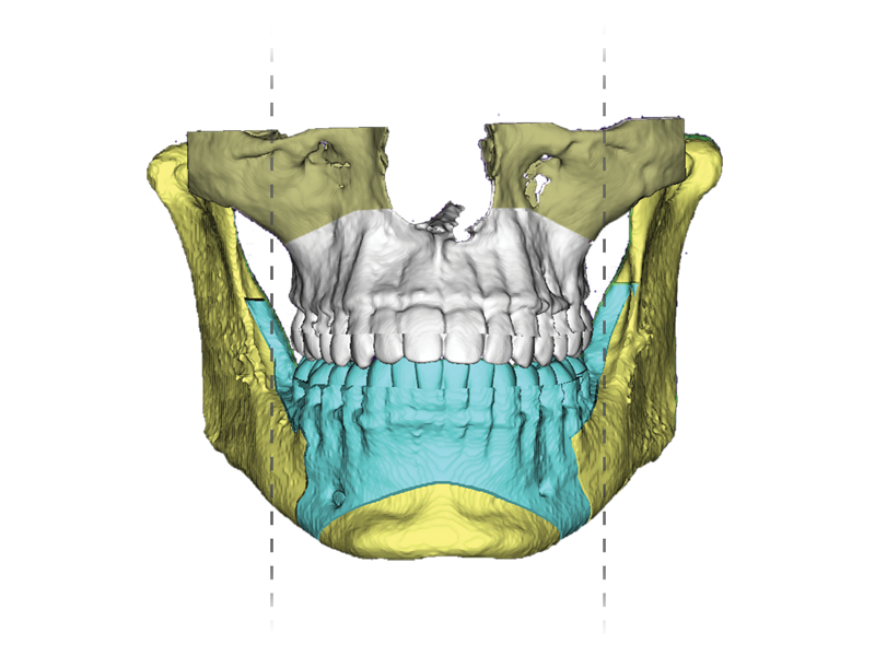Foto 3 de Dr. Alexandre Bellotti / Bucomaxilofacial