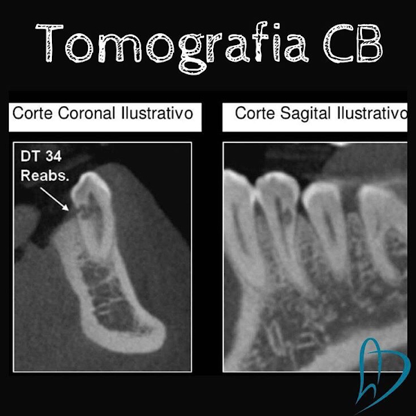 Foto 3 de Dr. Alexandre Dantas - Cirurgião Dentista