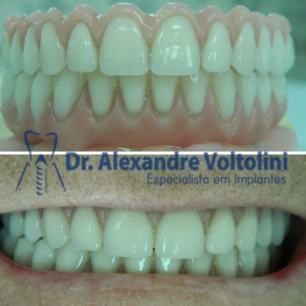 Foto 3 de Dr Alexandre Voltolini