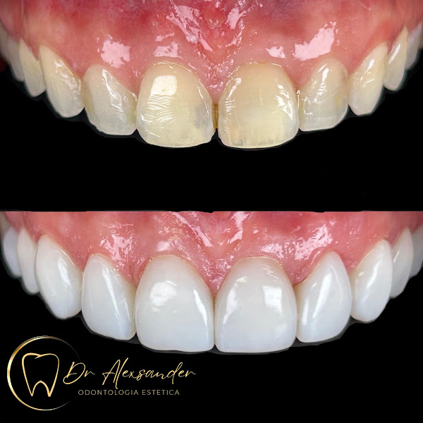 Foto 2 de Dr Alexsander odontologia estética