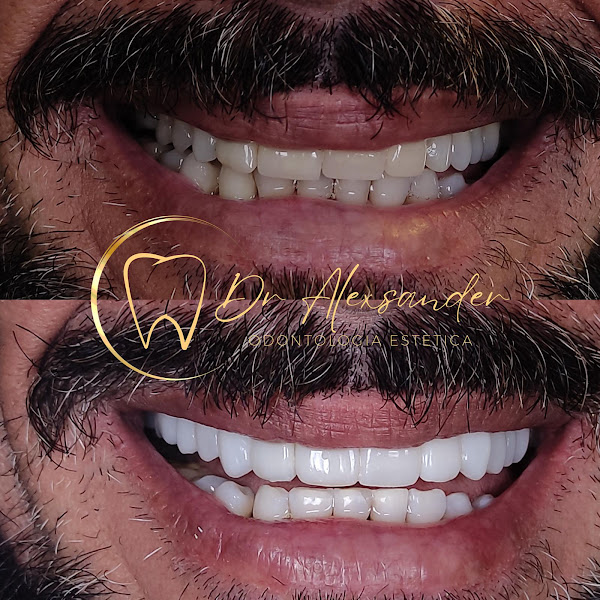 Foto 3 de Dr Alexsander odontologia estética